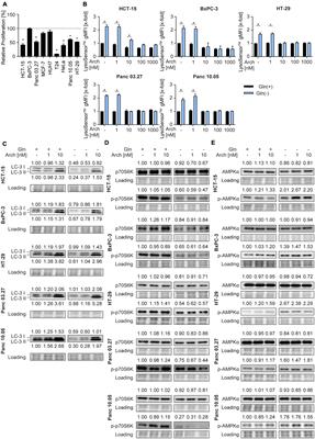 A metabolic shift toward glycolysis enables cancer cells to maintain survival upon concomitant glutamine deprivation and V-ATPase inhibition